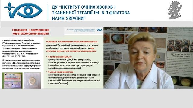 Основные направления работы отдела патологии роговицы д.м.н., профессор Дрожжина Г.И. Часть 2 смотреть онлайн