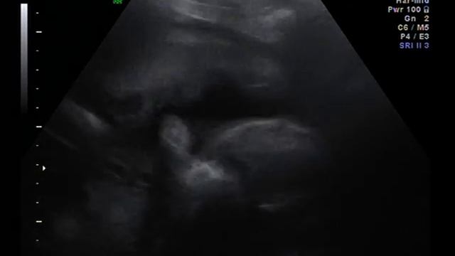 4d Scan of baby Gibson смотреть онлайн