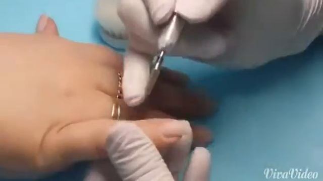 Маникюр в клинике DitrixMed на Островитянова смотреть онлайн