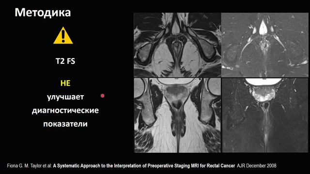 Опухоли прямой кишки 1 смотреть онлайн