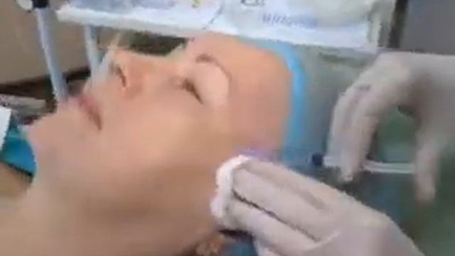 Пигментация смотреть онлайн