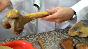 АНАТОМИЯ костей нижних конечностей