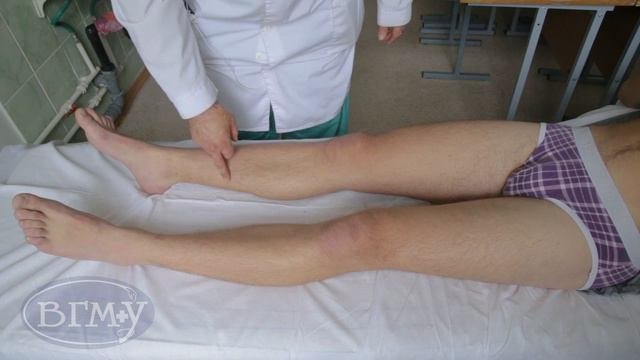 проекция вены большой подкожной