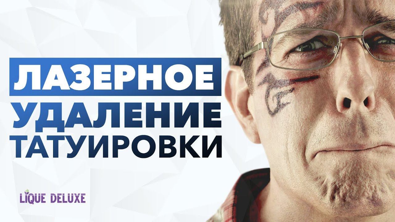 Как удалить тату. Лазерное удаление татуировки в Lique Deluxe. Удаление тату до и после
