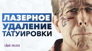 Как удалить тату. Лазерное удаление татуировки в Lique Deluxe. Удаление тату до и после