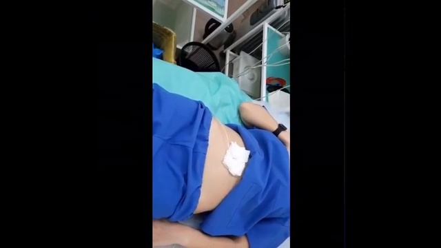 Кормление тяжелобольного пациента через гастростом.