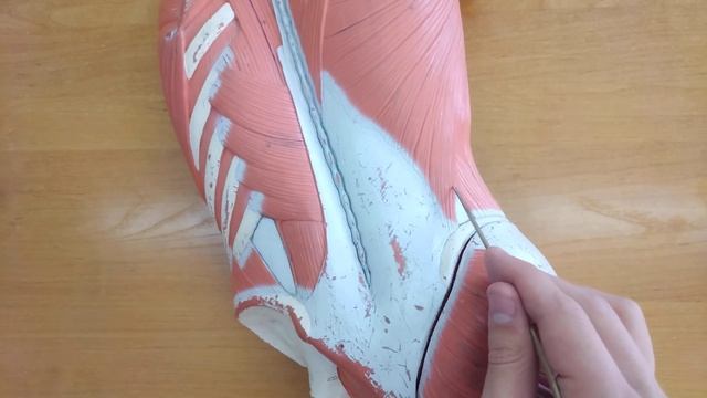 Слабые места задней стенки брюшной полости на вузовском муляже. Петитов треугольник. Миология.