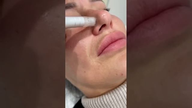 Микронидлинг смотреть онлайн