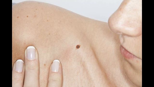 Интересно знать: Родинка смотреть онлайн