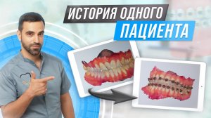 РОВНАЯ УЛЫБКА #брекеты #элайнеры