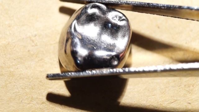 С зуба слетела металлическая коронка под музыку. смотреть онлайн