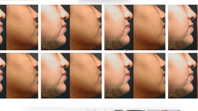 Лендинг для студии лазерная эпиляция смотреть онлайн