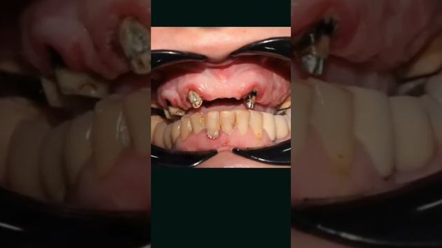 Преображение улыбки?
