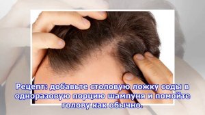 Как избавиться от перхоти: 10 проверенных средств