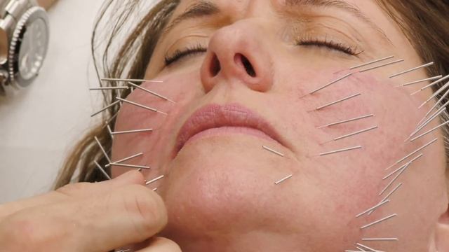 натуральный “филлер” смотреть онлайн