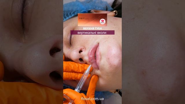 Техніки створення чуттєвих губ з 💉MiFill Volume