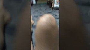 Вывих, подвывих колена.