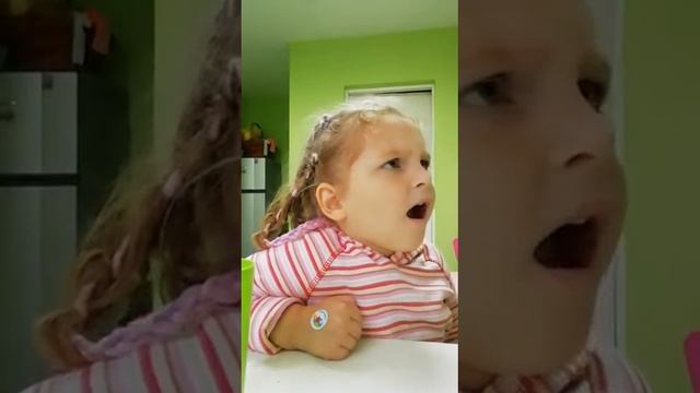 Исправление  мезиального прикуса .