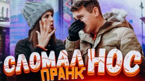 СЛОМАЛ НОС|Реакция людей