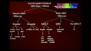 15.ECG  summary  - Dr. M Cheniappan