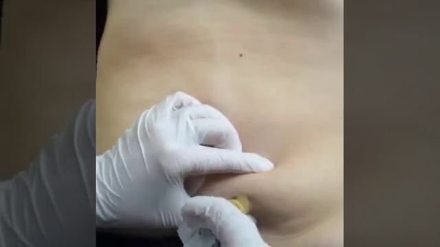 Купить мезопрепараты в Махачкале  Обучение Мезотерапии   www klinikakda ru