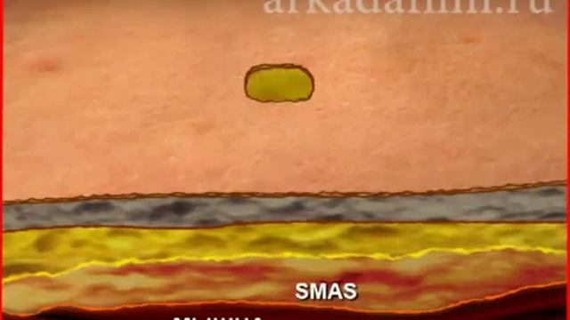 Рекламный ролик клиники Helen Baden смотреть онлайн