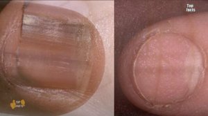 ПРО ЧТО ГОВОРЯТ НОГТИ?