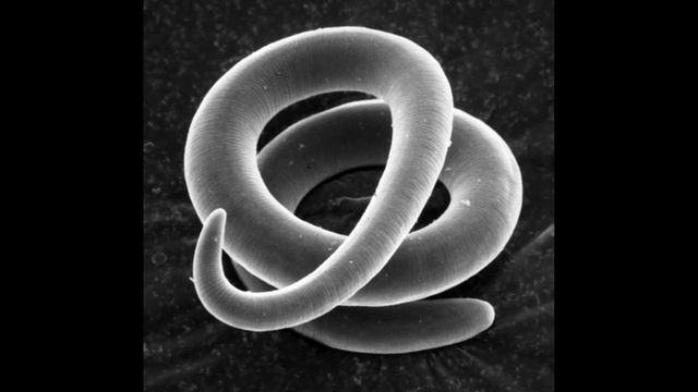 Трихинелла - Trichinella spiralis - Трихинеллез: Жизненный Цикл, Симптомы, Диагностика, Профилактик смотреть онлайн