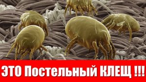 Как избавиться от пылевых клещей в домашних условиях .Чем вредны клещи домашней пыли.