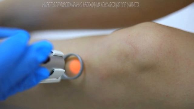 Эпиляция смотреть онлайн