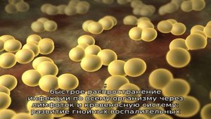 Золотистый стафилококк в носу