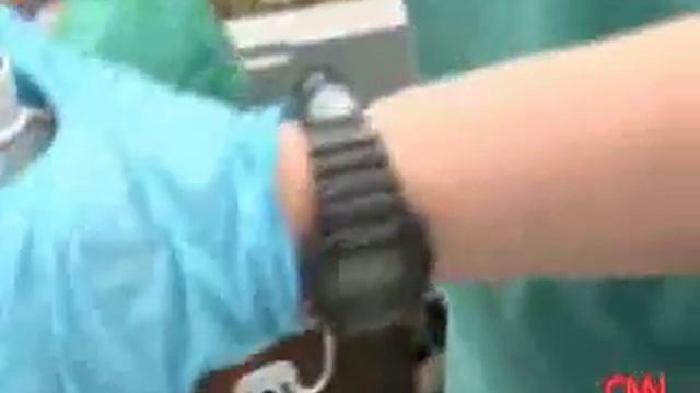 How does a Propofol injection work? Dr. Sanjay Gupta and Dr. Raphael Gershon on CNN смотреть онлайн