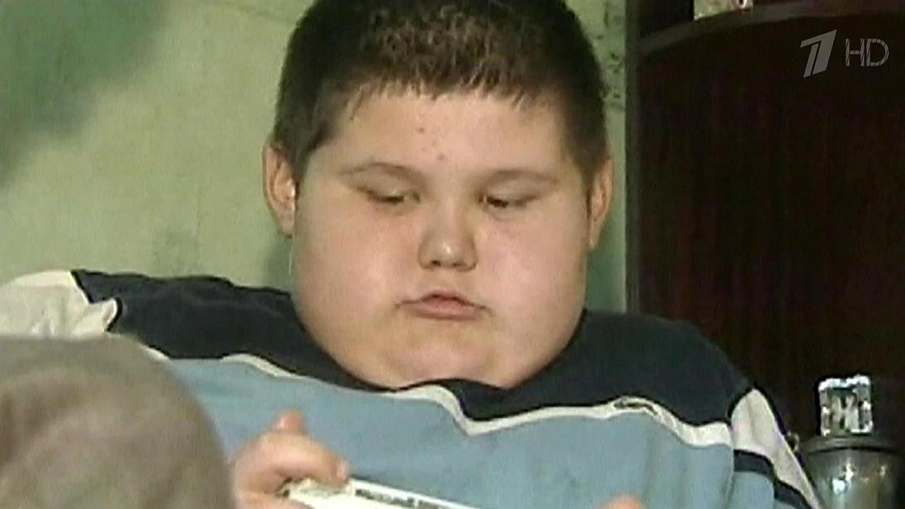 Подростковое ожирение становится настоящей эпидемией мирового масштаба