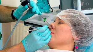 Как избавиться от храпа. Здоровье. Фрагмент выпуска от 02.04.2017