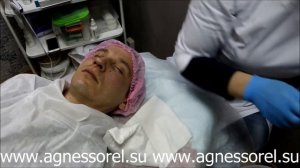 Agnessorel.Su - косметологический комбайн для лица Micros 6D,7D