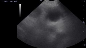 Пиометра у собаки УЗИ диагностика