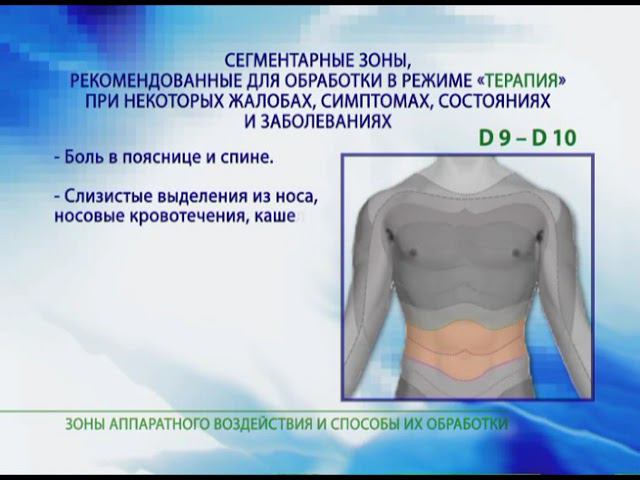 Зоны воздействия аппаратами ДЭНАС