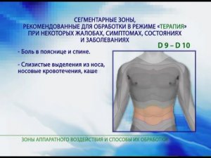 Зоны воздействия аппаратами ДЭНАС