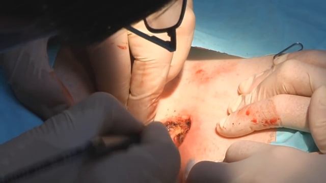 Копчиковый ход Мухин смотреть онлайн