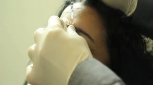 Инъекции Ботокса в эстетической медицине для удаления морщин