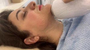 Как проходит процедура лазерная эпиляция ?