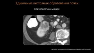 КТ Абдоминальная визуализация  16  Лекция «КТ почек и МВС»  Лектор  Пихута Д А  2