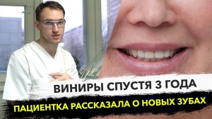 Виниры спустя 3 года. Как носятся? что можно кусать винирами?