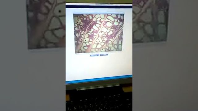 Гистология Молочная железа (Женская половая) смотреть онлайн