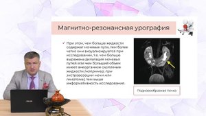 Гидронефроз. Диагностика, лечение
