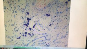 Органоспецифические особенности тучных клеток