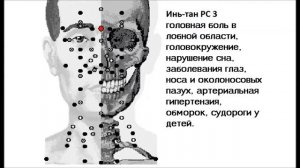 Акупунктурные точки от эпилепсии