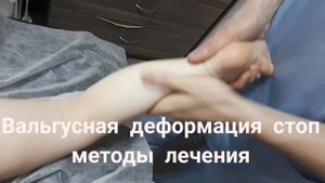 Вальгусная деформация стоп методы лечения #лфктюмень #массажжетский тюмень