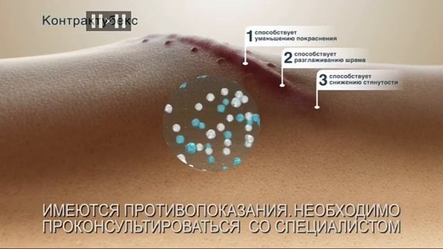 Контрактубекс отзывы до и после