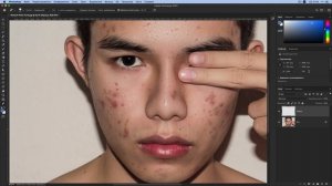 ?Как убрать прыщи в Фотошопе — ?лучший способ удалить прыщи в Фотошоп